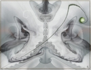 Glyph 14